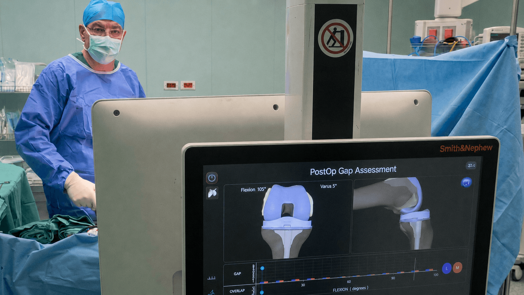 CORI System — real-time knee implant assessment