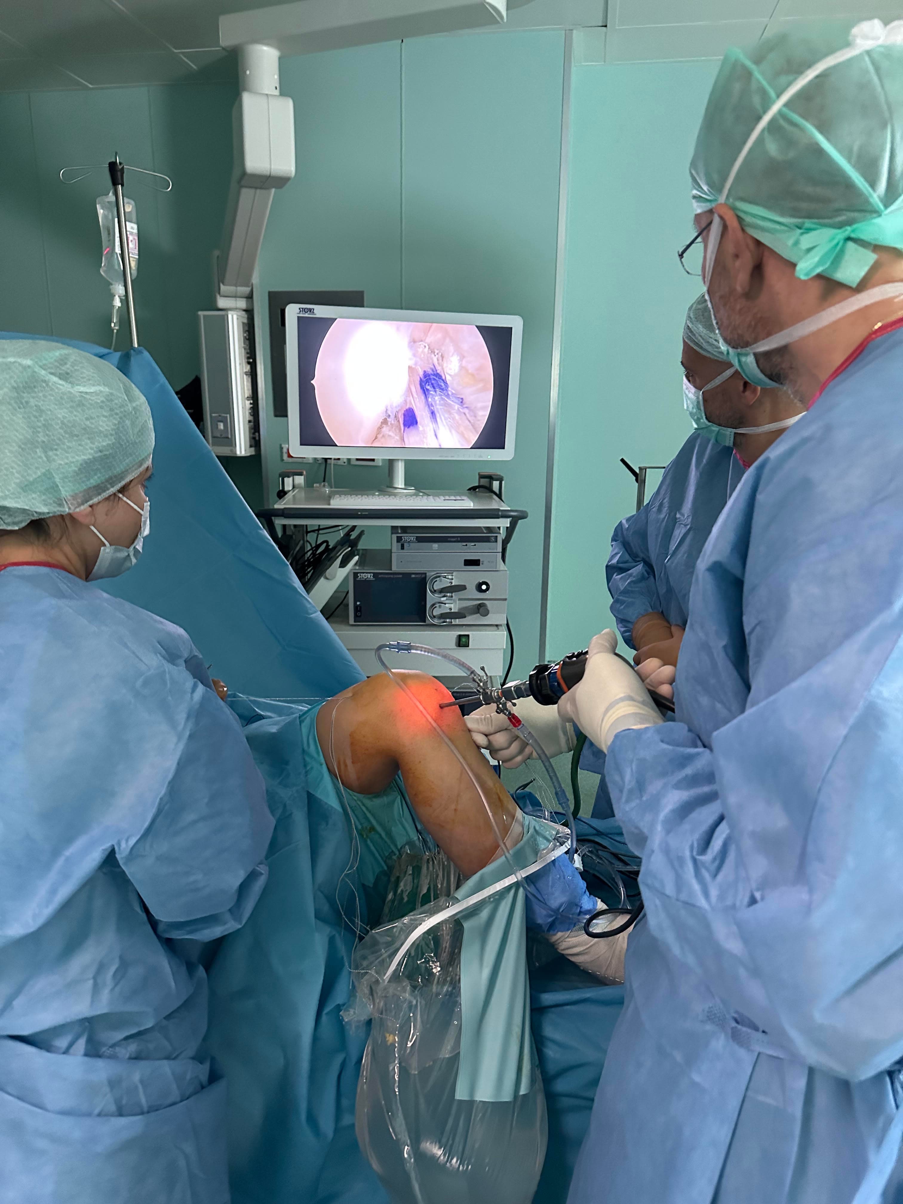 Arthroscopic knee surgery — high-definition monitor view during the procedure